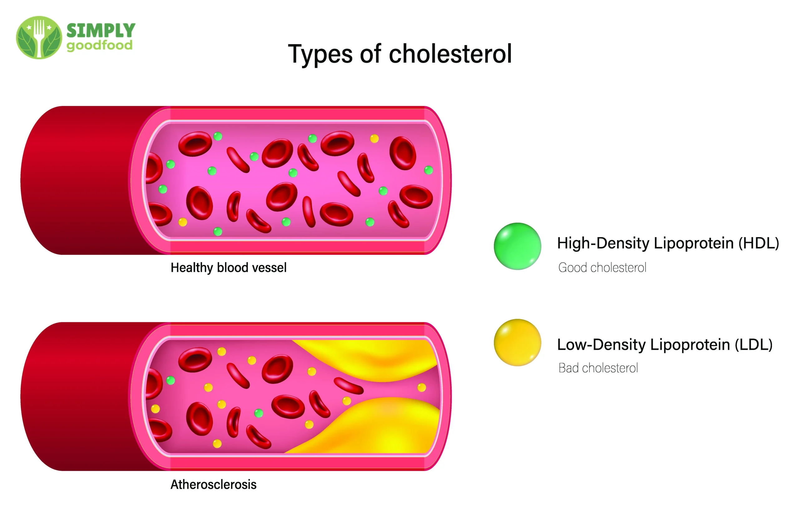 Trứng gà giàu cholesterol tốt (HDL) và xấu (LDL), tốt cho sức khỏe và làm đẹp da.