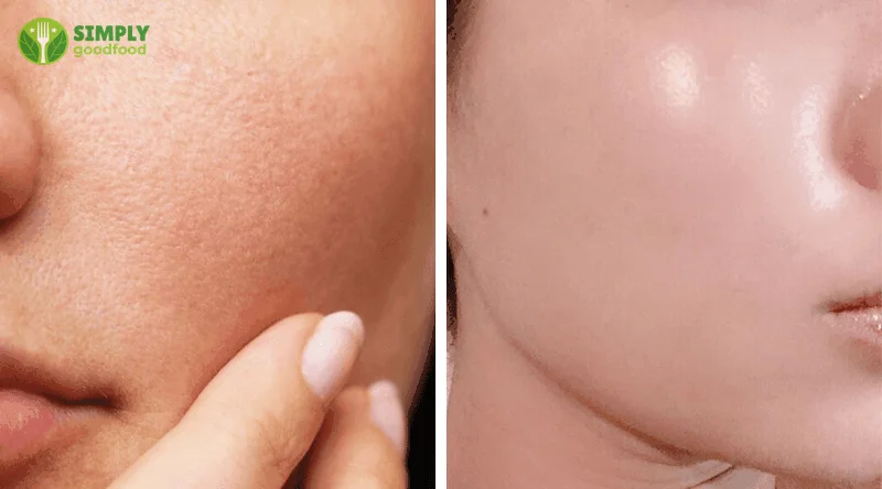 Cà chua giúp se khít lỗ chân lông, làm đẹp da hiệu quả